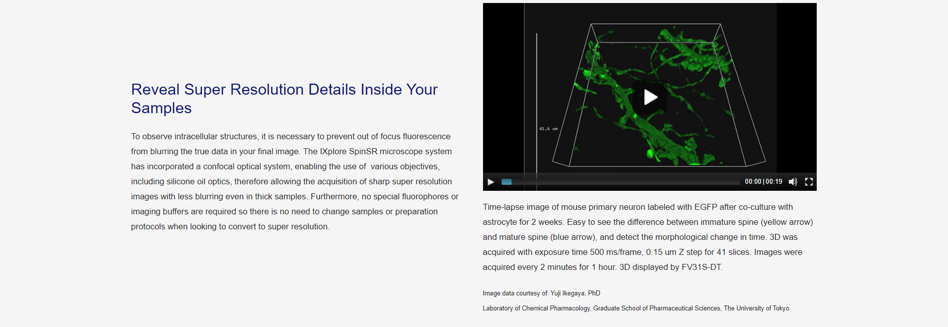 超高分辨率转盘共聚焦显微镜(图5)